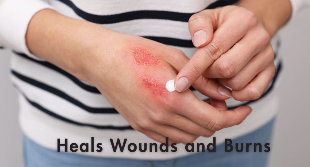 Heals Wounds and Burns
